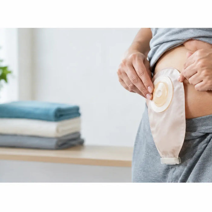 Como prevenir vazamentos em estoma no dia a dia