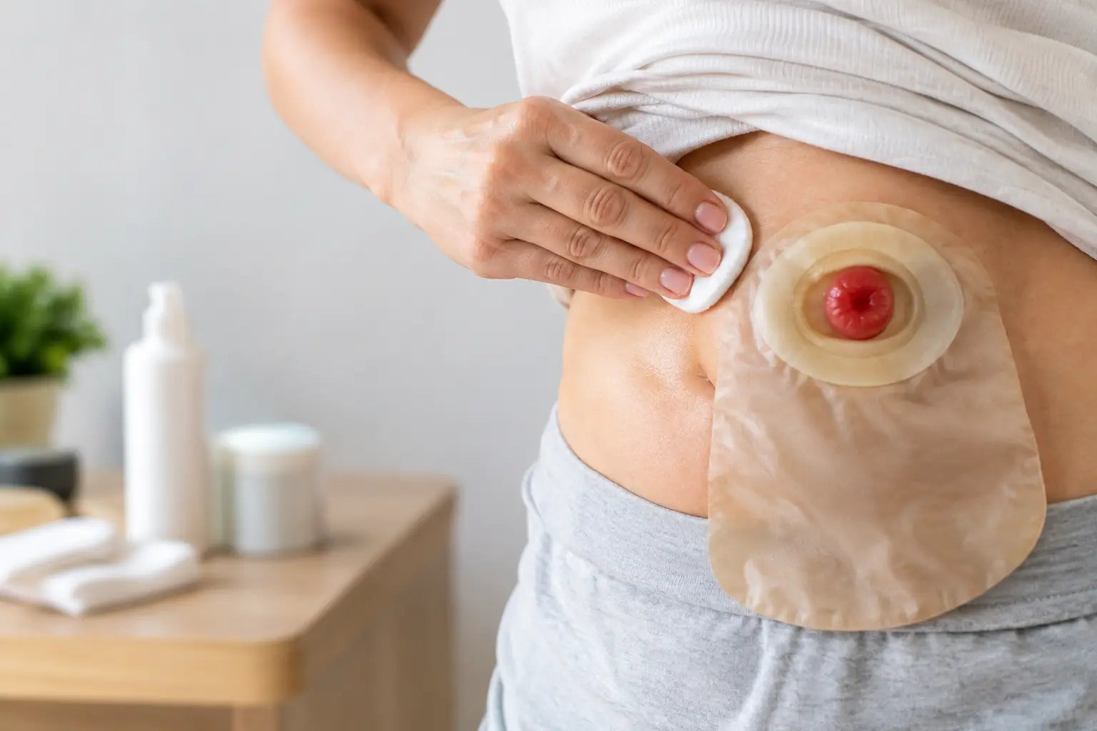Cuidados com a pele periestomal na ostomia